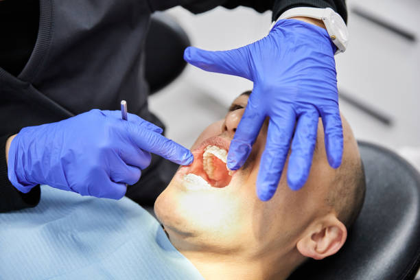 Best Emergency Care for Gum Disease in Saw Creek, PA